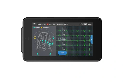 ليبو الطبية PCECG-500 الجيب ECG جهاز محمول مزود بـ 12 طرفًا يستريح لمراقبة تخطيط القلب